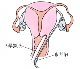 幼儿学画画，广州捐卵宝宝学画画，学画画的好处，如何学画画